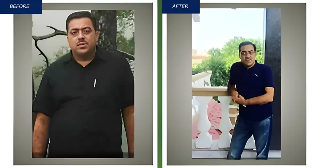 dietician-for-weight-gain-in-Noida